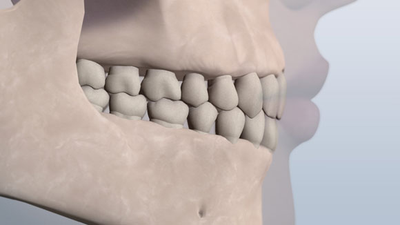 Normal bite illustration