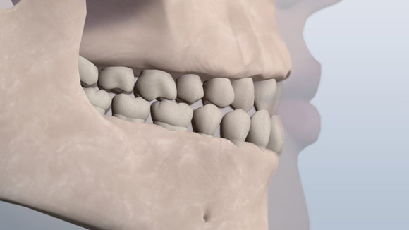 Dental bite illustration