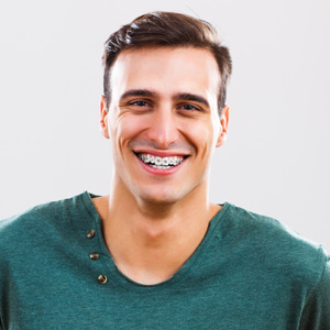 Adults and braces