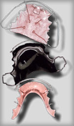 Orthodontic appliances