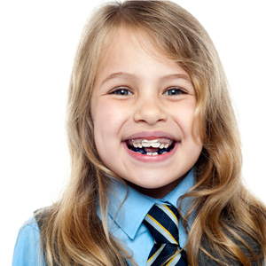 Children and braces