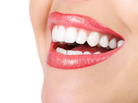 Clear braces